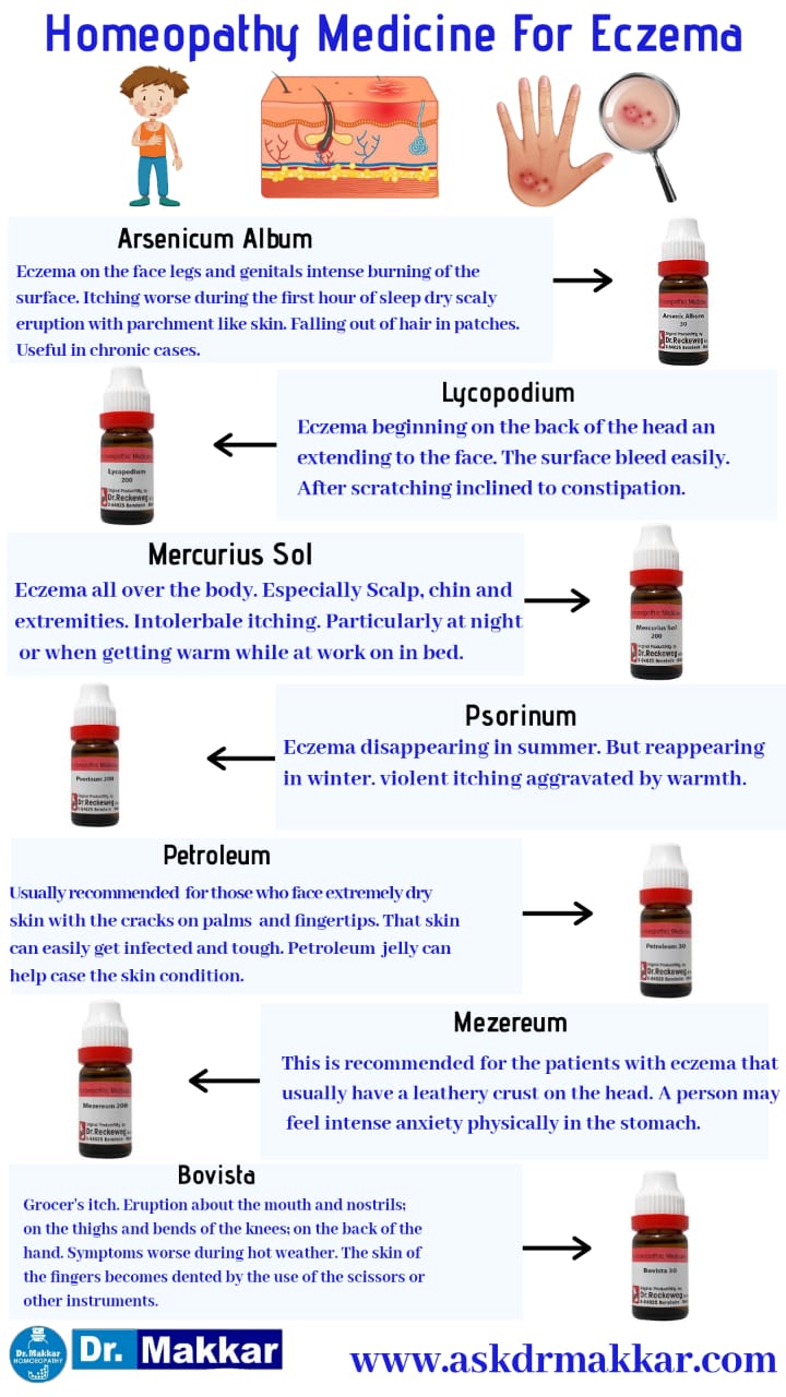 Eczema homeopathic treatment